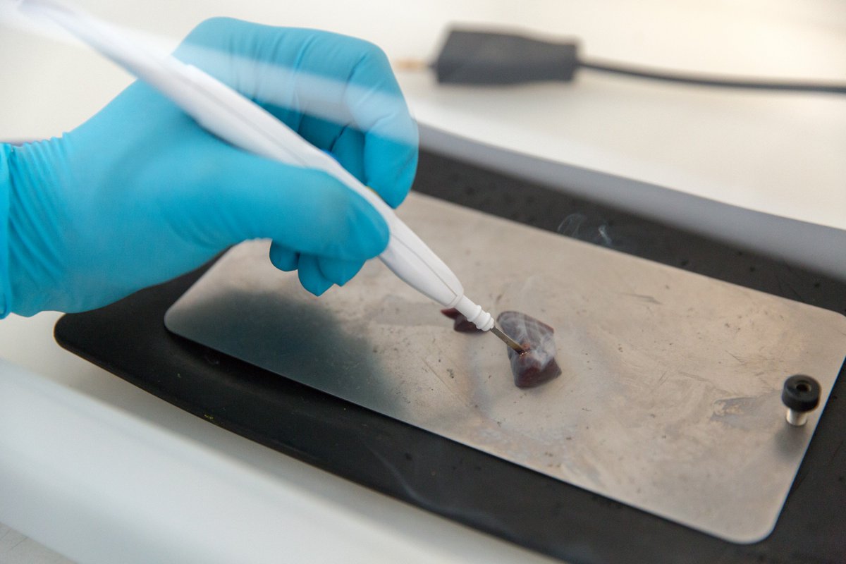 iKnife recognised for its role in #breastcancer surgery bit.ly/2tWFJjS