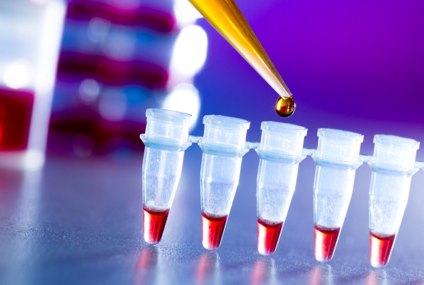priya14211's tweet photo. Global #Biopharmaceuticals Market is estimated to reach $405 billion by 2024; growing at a CAGR of 9.3% from 2016 to 2024. 
Download Free Sample Copy of Report @ https://t.co/EQhamWn3lo https://t.co/ysi7fvdmwW