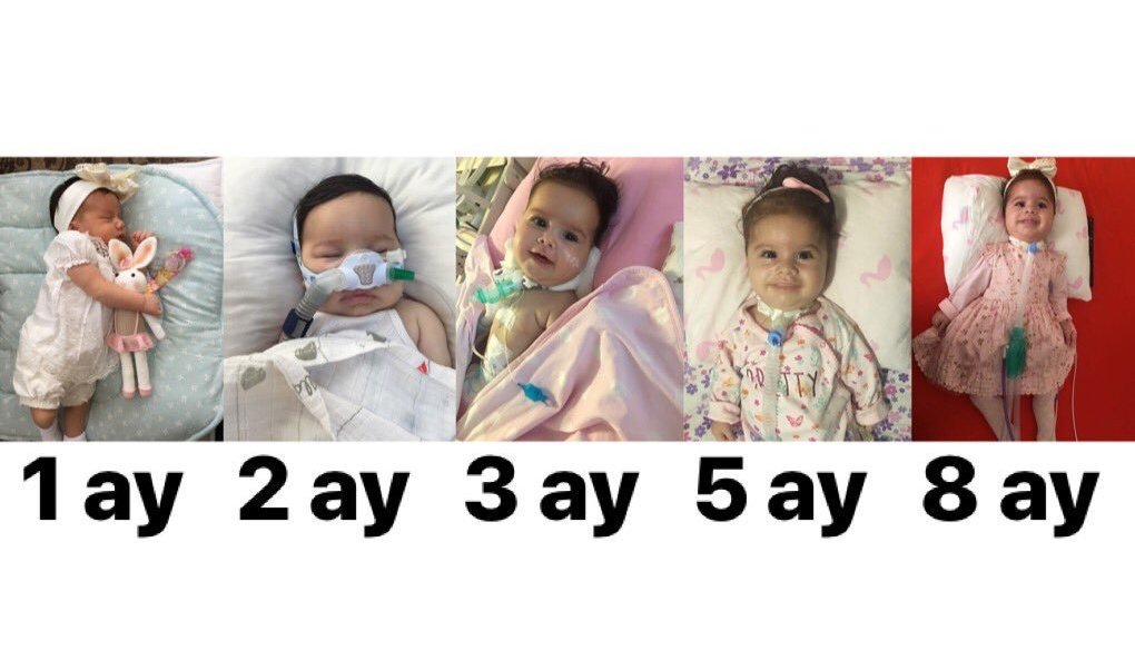 SMA Destek Platformu (@smadestek) on Twitter photo #ÇocuklarGeleceğimizdir diyebilmek için önce onlara geleceklerini vermek gerekli. SMA hastası çocuklarımız ilaç bekliyor, yaşama şansını istiyor.
#suSMAilacımıver 
#SmailacınıSGKödesin #ÇocuklarGeleceğimizdir diyebilmek için önce onlara geleceklerini vermek gerekli. SMA hastası çocuklarımız ilaç bekliyor, yaşama şansını istiyor.
#suSMAilacımıver 
#SmailacınıSGKödesin