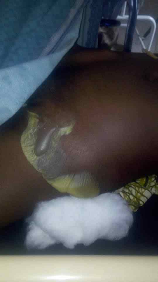 IamMoreshould's tweet photo. A 300L student of (LASU), David has been on d sick Bed for weeks suffering 4rm d Disease called Fournier Gangrene.
He's in need of 500k to carry out a plastic surgery.
Acct👇:
0071719697
Tejumaiye David
Diamond bank.
Pls RT Helper is on ur TL
#SaveDavidSoul @segalink https://t.co/PQKG1mnd4o