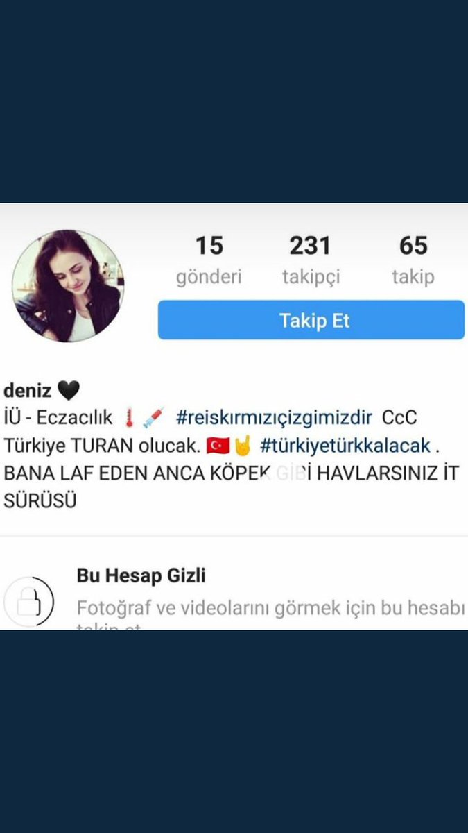 Zeynepzeyne1's tweet photo. Şu Allahın cezasını şikayet edin spam atın😡😡 birde Eczacılık okuyor yarın öbür gün topluma karışacak toplum için ne kadar tehlikeli bir pisliksin sen o ana babanın yüreği yanıyor Allah belanı versin senin
#akfc #mafc #ükfc #safc #sıfc #mkkfc #survivor2018 https://t.co/k2AnlJhgoA