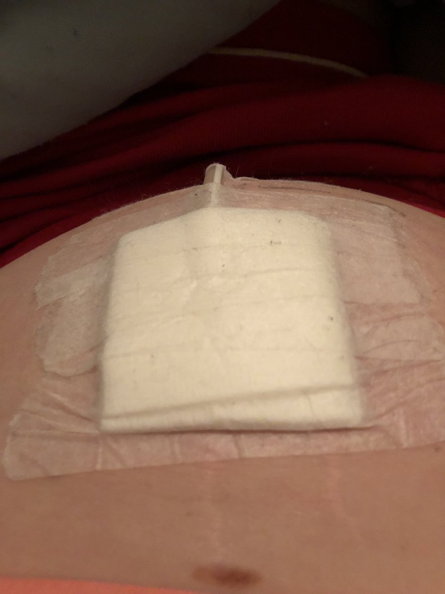 desi_is_kool's tweet image. ‼️‼️PLEASE RETWEET‼️‼️ I am in need of a Kidney. I do nightly dialysis for 9 and half hours everyday as well as deal with all of the side effects. Thank you so much for retweeting. And I need O blood type.