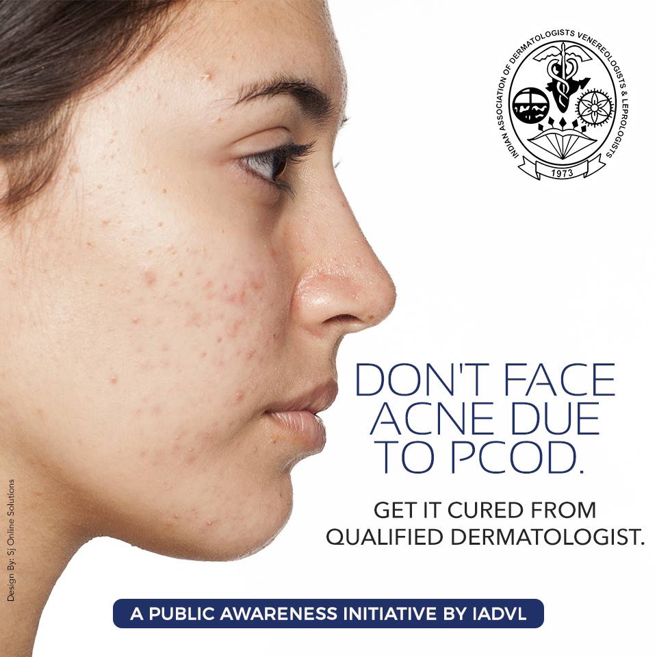 Acne due to PCOD or PCOS is a very common phenomenon &amp; nothing to be scared about. Consult a qualified dermatologist today!

#IADVLSkin #IADVL #PCOD #PCOS