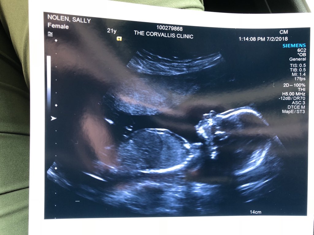 sallyfishsticks's tweet photo. This little button nose makes getting fat seem like a good time😍 #growbabygrow https://t.co/9b1HqKVhpS
