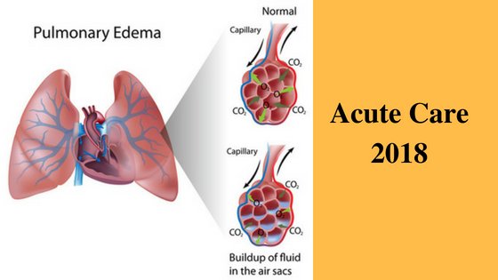 кардиогенный отек легких. коронарный отек легких. механизм кардиогенного отека легких. кардиогенный отек легких. коронарный отек легких.