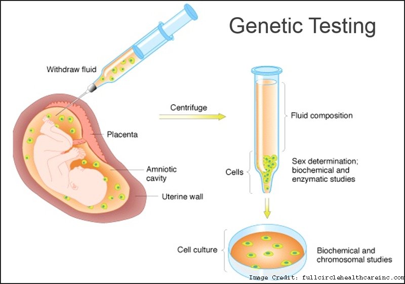 Evlin_Symon's tweet photo. Is #Genetic Testing Really Helpful?
https://t.co/MDQVlwOSTD https://t.co/OAZ3RP3uLX