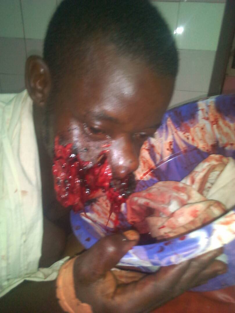 DanielNdofor's tweet photo. A peasant farmer that was shot by #Cameroun soldiers on his way to the farm this morning in manyemen.And #French soldiers are helping them because of resources. #France will become a third world country soon. @BBCWorld @RFI_English @algore @cnni @innercitypress https://t.co/psF5S61Z2E