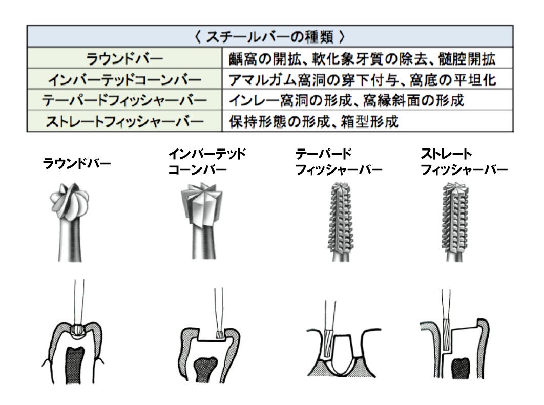 歯科医師のための一問一答 בטוויטר スチールバーの種類