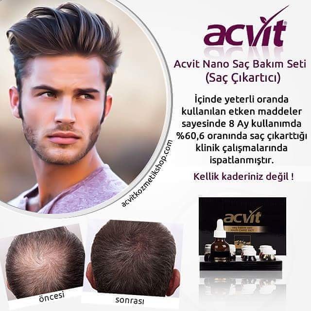 Acvit Nano Saç Bakım Seti - 
Saçınızı Baştan Çıkarın! Özgüveniniz Yüksek Olsun 
İçinde yeterli oranda kullanılan etken maddeler sayesinde 8 Ay kullanımda %60,6 oranında saç çıkarttığı klinik çalışmalarında ispatlanmıştır.