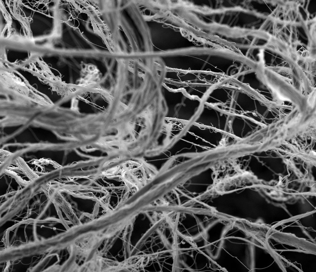 #WhatDoesACellSee 
#ExtraCellularMatrix
This is a 60 * 50 µm picture.