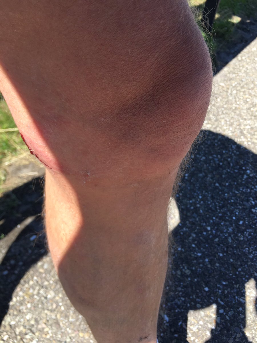 Zou iemand mij ook kunnen helpen? Ik ben zaterdag jl rond 15:20 aangereden op de #Heerezijlbrug in #Terherne door een auto met trailer erachter en daarop een grote #roeisloep. De bestuurder komt uit #Sneek. Stuur mij aub een dm of bel op 06-29065357 met gegevens van deze persoon.