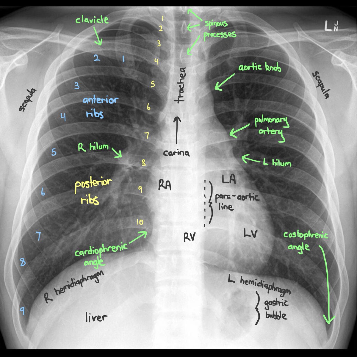 Sam Ghali, M.D. on Twitter "There’s a lot more to a Chest