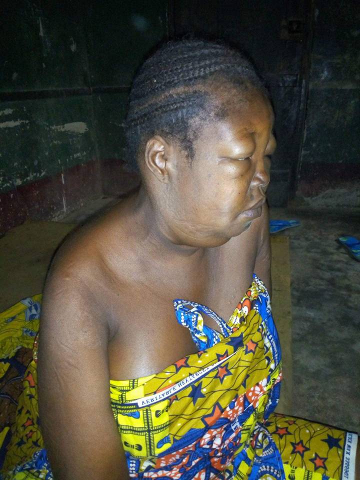  31-years-old woman in need of 12M for Kidney transplant