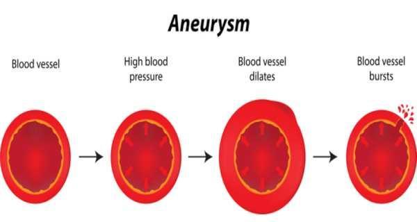 WDEC2018's tweet photo. Diabetes &amp; Aneurysms | WDEC2018 | CME CONFERENCES https://t.co/CLsEJO2x7E https://t.co/fxqyWAsWE2