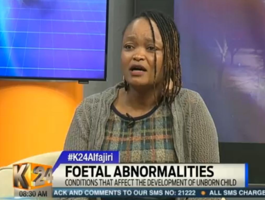 K24Tv's tweet photo. Ruby Kimondo: Mothers of preterm babies experience anxiety. #K24Alfajiri @SerahTeshna https://t.co/v3NLSxRHuq