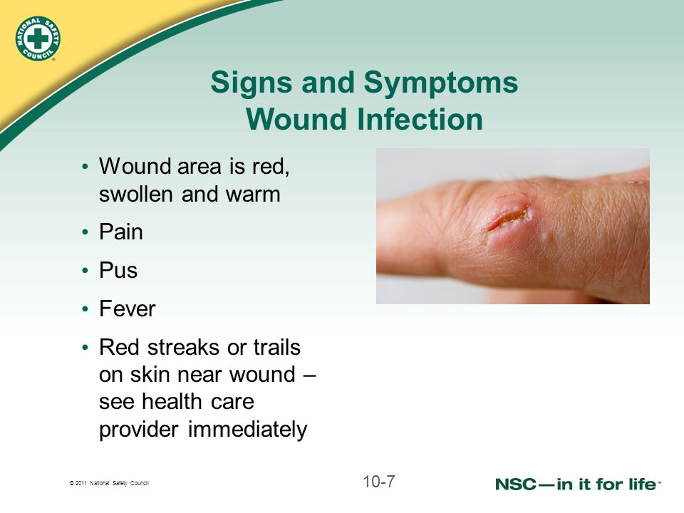 How to tell if a wound is healing or infected