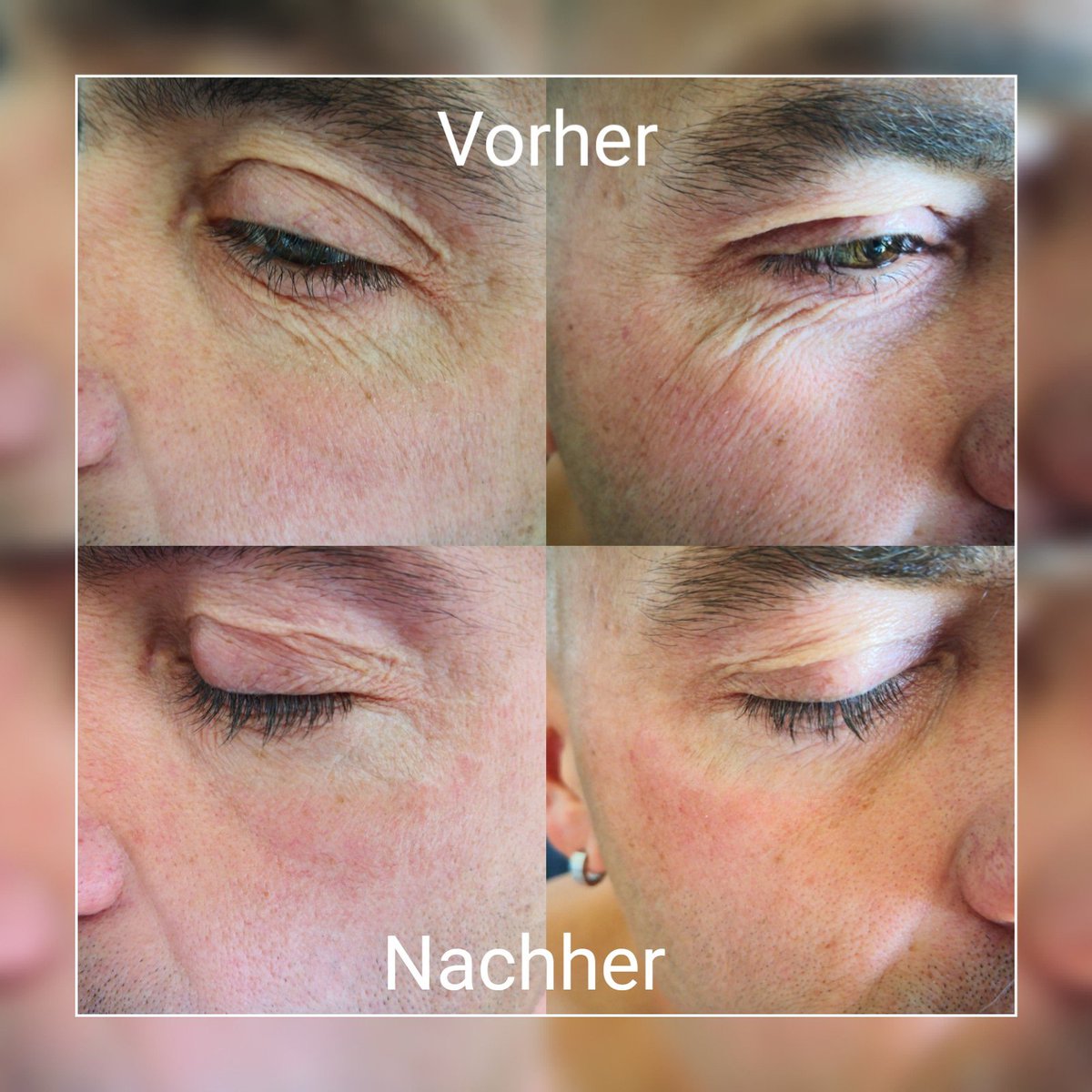 EffektK's tweet photo. Echt der absolute #Knaller! Wirkt sofort, beseitigt #Falten. Mit langanhaltender #Wirkung Nach nicht mal 5 Minuten! https://t.co/QLW2rsBg8b