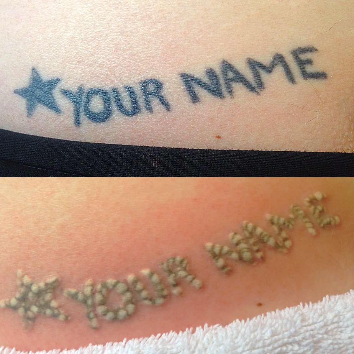 bionicremoval's tweet photo. This ‘your name’ lower back ink was my pleasure to vaporize #bionic #bionictattooremoval #lasertattooremoval #tattoo #lowerbacktattoo #yourname #mypleasure #mustgo #happyclient #moveon #beforeandafter #winnipeg #manitoba https://t.co/wCtKiCkExP