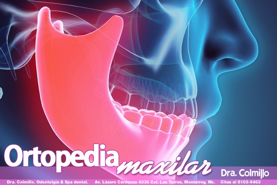 DraColmillo's tweet photo. ¡CONOCE NUESTROS SERVICIOS!
Ortopedia maxilar
Redirige el crecimiento facial de tus hijos en desarrollo con ortopedia maxilar
#ortopediamaxilar #hyrax #extraoral
¡Te esperamos en el consultorio!
Lázaro Cárdenas 4336. Col. Las Torres.
Citas al 81039463.… https://t.co/XCe9tel0i5