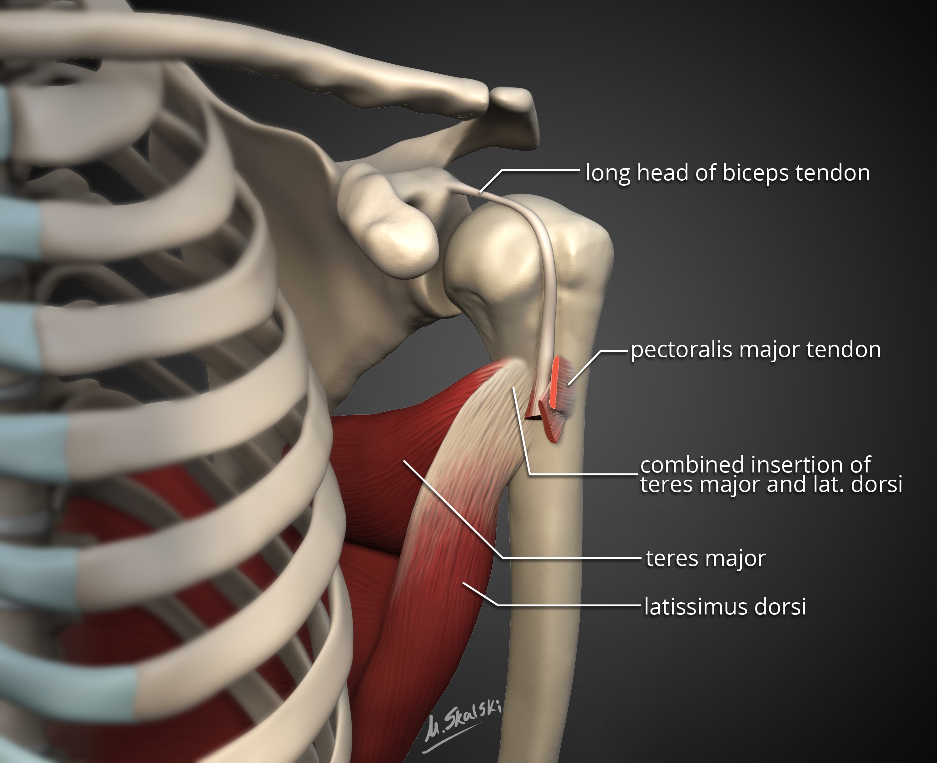 Intertubercular Groove Latissimus Dorsi