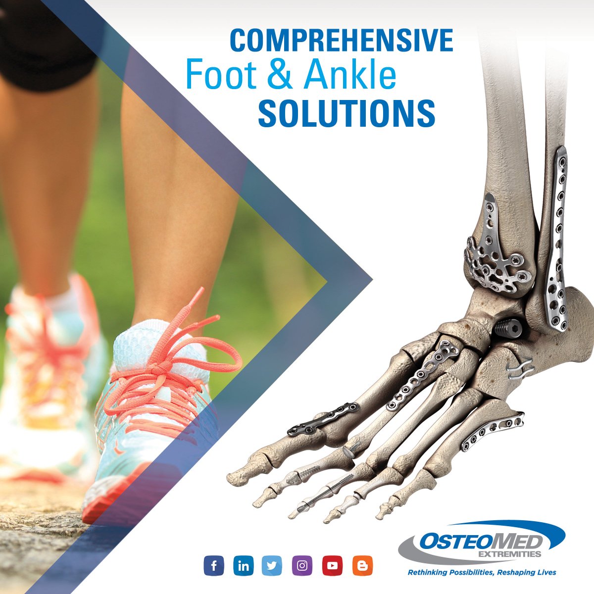 OsteoMedSOURCE's tweet photo. Please, come visit us at booth #421 here at #AOFAS2018 in Boston, MA! Our reps will be discussing our various #foot and #ankle products. Also, OsteoMed will be conducting a foot and ankle course this upcoming week on July 16th & 17th featuring Dr. Erroll J. Bailey. https://t.co/teFNqx9JsV