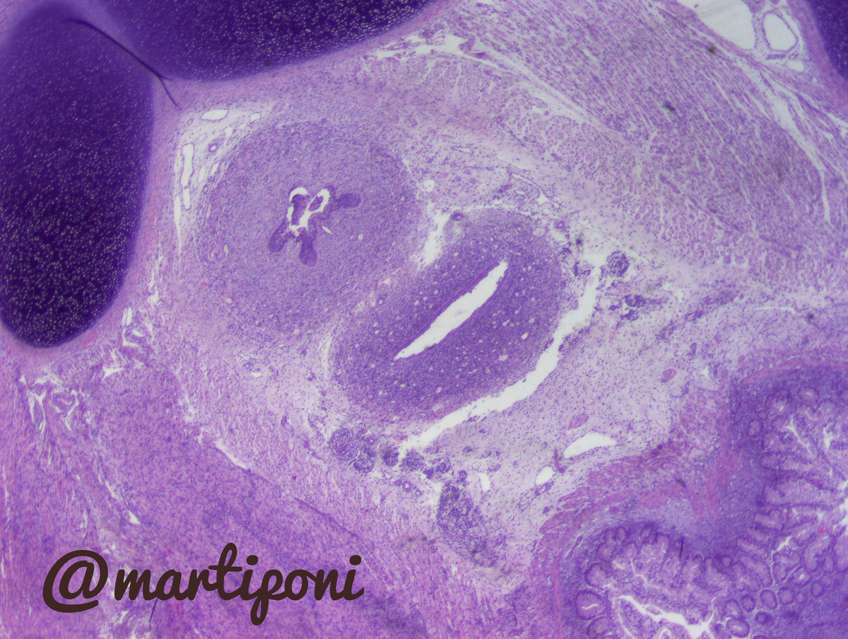 martiponi's tweet photo. Cross section cross of fetal pelvis, 15w. Is this a boy or a girl? @armandoreques #pediPath #fetalPath #autopsy https://t.co/bkYdPOD7UG