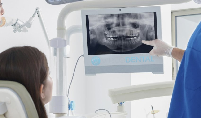 VideoDentalConc's tweet photo. How Portable X-Ray Systems Are Changing Dentistry #PortableXRay #Dentistry #DentalRadiography #HandheldXRayMachine #xraygenerator #dentalimaging #VideoDental https://t.co/6hN6hsuhVC https://t.co/lB1yp6LVXT