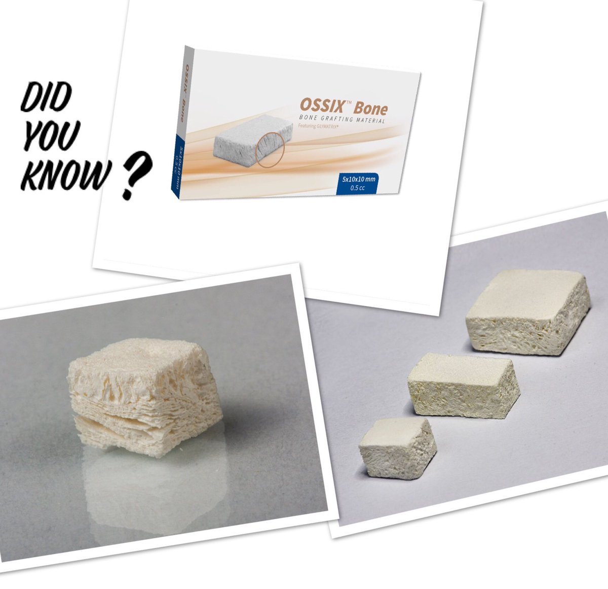 Hesira_Med's tweet image. #ossixbone is used for #socketpreservation following any #extractionprocedure in #closedsinusaugmentation prior to or in conjunction with #implantplacement in #lateralandvertical #boneaugmentation to #correctbonydefects in #implants with #peri-implantitis #buyisraeli #buycanadian