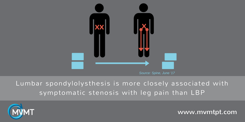 mvmtPT's tweet image. Lumbar Spondylolisthesis is the anterior (or posterior) slippage of one vertebrae on the vertebrae below it. Lumbar spondy correlated more with symptomatic lumbar spinal stenosis than low back pain, in this 2017 study. mvmtpt.com #MoveToLive #mvmtpt