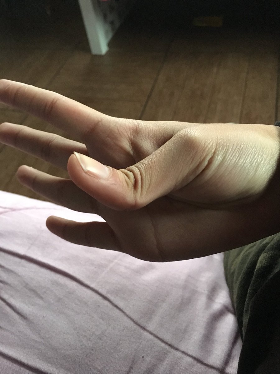 Ivo_falcone's tweet photo. Rt a la Mano de Valentina o 2 años de pruebas desaprobadas https://t.co/dRkLx6tZTD