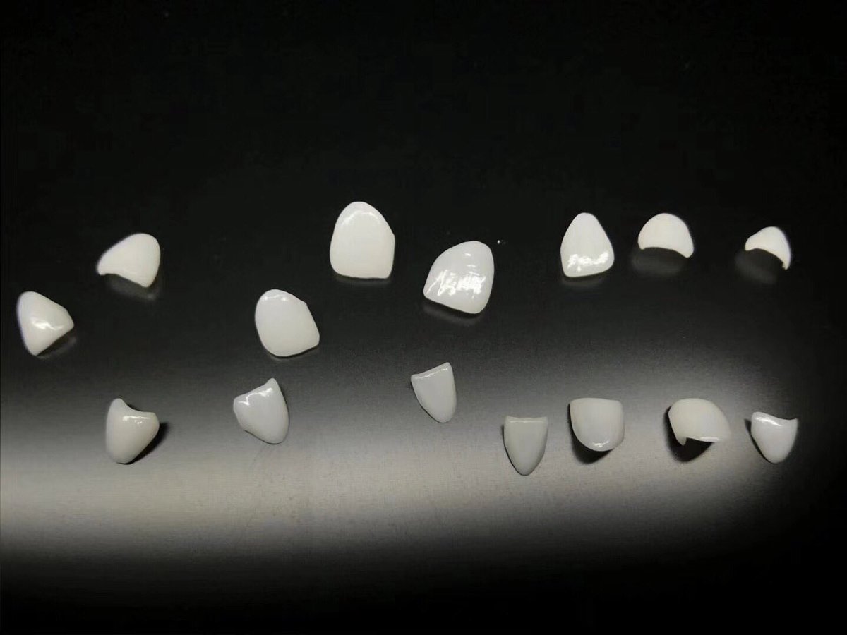TOP_dentallab's tweet photo. Veneer work by us from TOP Dental Lab in Shenzhen China ❤️if you need any outsourcing service from us, contact me😉 #topdentallab #topdental #veneers #veneer #allceramic #dentallab #dentaltechnician #prothetics #anterior #falseteeth #denture #dentist https://t.co/VS2jS1XxDJ