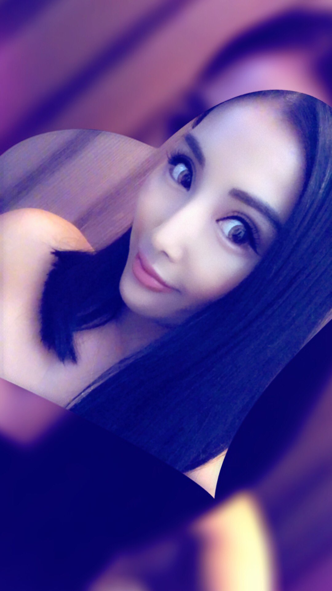 一条ありさ リフト前の私 顔がコケてたから腫れない予定だったが やはり二割り増しくらいに腫れてる Morning 姉agehaのモデルの子達も沢山taクリニックでリフトアップしてるからインスタのストーリー見て連絡くれてダウンタイムの