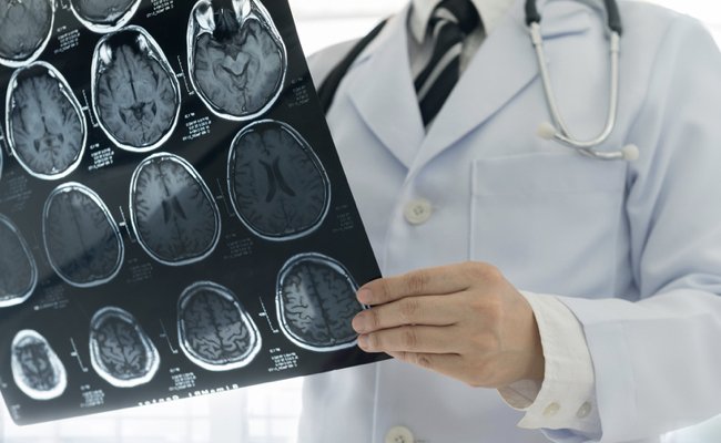 This is why I recommend 250mg a day of a pollutant-free source of long-chain omega-3 fatty acids. bit.ly/2KwjUD7