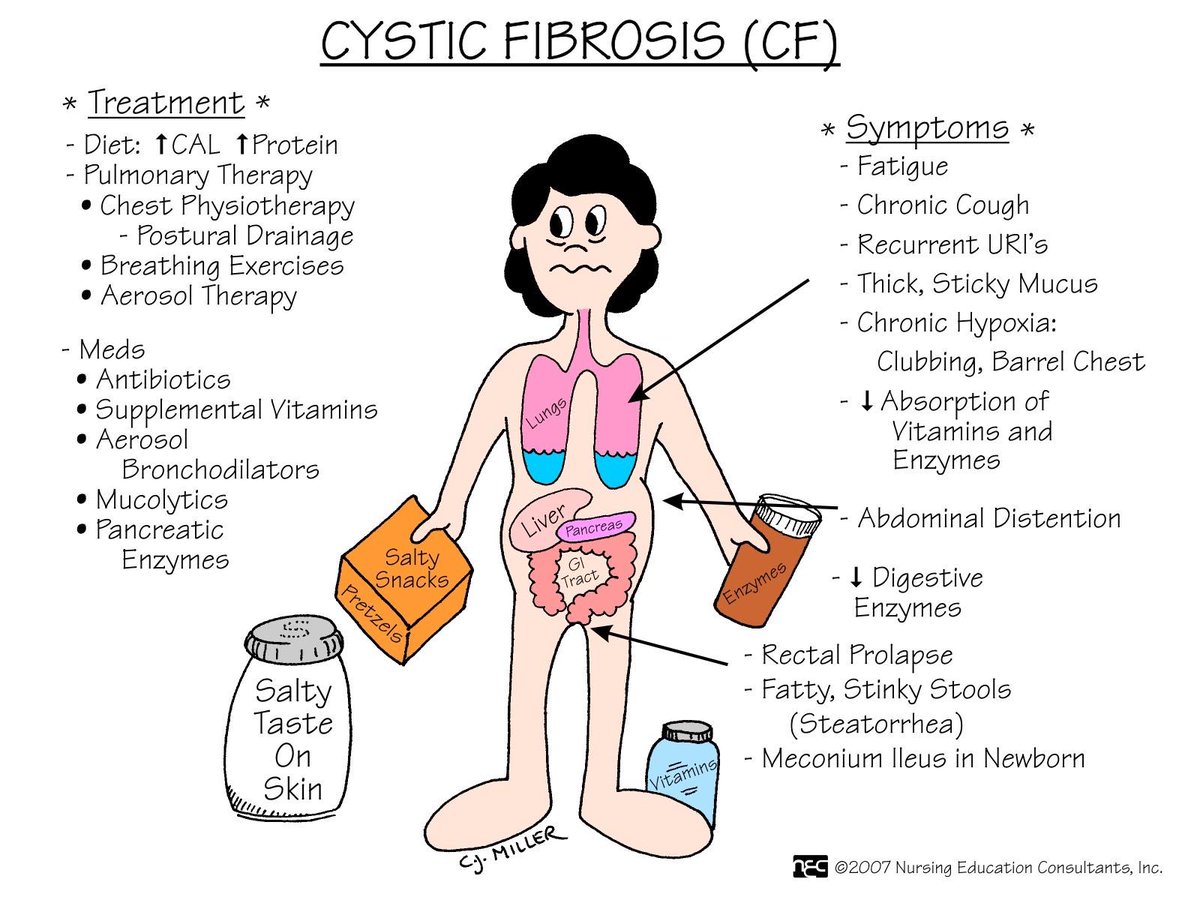 ãcystic fibrosis nursingãçåçæå°çµæ