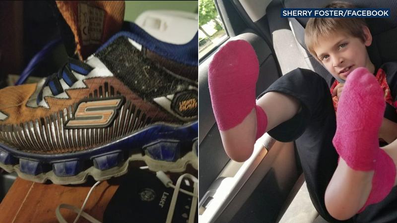 6abc's tweet image. Skechers shoes that light up burn boy's feet after getting wet, mother says. 6abc.cm/2m0PxFZ