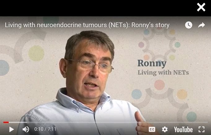 RonnyAllan1's tweet image. “What are you doing this afternoon” - a diagnostic story about #NeuroendocrineCancer @NETCancerBlog #livingwithnets  buff.ly/2N2nFwF