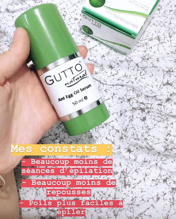 cosmetonature's tweet photo. L’épilation définitive de @Melle_Jude suit son cours et les résultats sont au rdv grâce à #gutto 🙌🐜 #epilationdefinitive #cosmetonature #ciaolespoils #huileoeufsdefourmis #repost https://t.co/wzNxPPPBX9