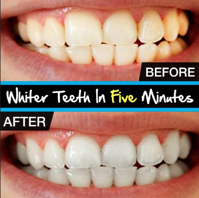 RockStar Mouth - Lifetime Discount 20% OFF!
Amazon Coupon Code: ROCKEN
amazon.com/TEETH-WHITENIN…