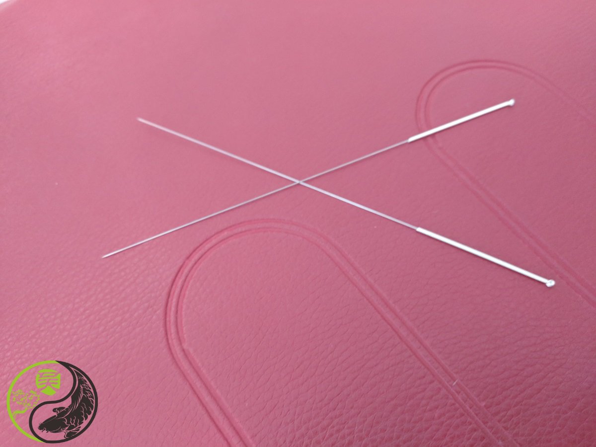 BChineseMedCtr's tweet photo. To stimulate the #acupuncture points, the most common method is with special needles. At our clinic, the  needles are disposed of after each use to prevent contamination. #BCMC #TCM https://t.co/wIGDNhDTdu