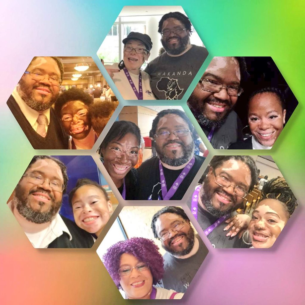 dapurplediva's tweet photo. my #MySkinFamily @#WVD18CONF In #WorcestorMassachusetts #weAreVitiligans #Borndifferent #TeamVitiligo #vitiligofamily embracin da skin we're in #CantCureDopeSkin don't care #vitiligo4life I enjoyed meeting....dem😎😎😎😍😍😍😍 https://t.co/tqslCrv6g3