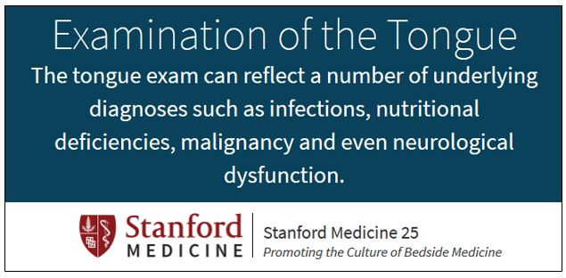StanfordMed25's tweet photo. Findings in tongue pathology include smooth tongue, geographic tongue, furrowing & ulcers. Review their clinical significance here: https://t.co/J1VlQASh7t #meded #beded https://t.co/i1sGRmL1Lm