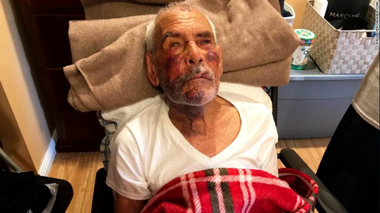 jimmurphySF's tweet photo. He was just visiting his family.

"Tears glistened on the black and purple bruises covering 91-year-old  Rodolfo Rodriguez's face as he described being attacked by a group of  people while going for a walk on the Fourth of July." https://t.co/iNv9b9a5rj https://t.co/SgTNt3yFA2