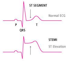 Dublin Fire Brigade tweet media
