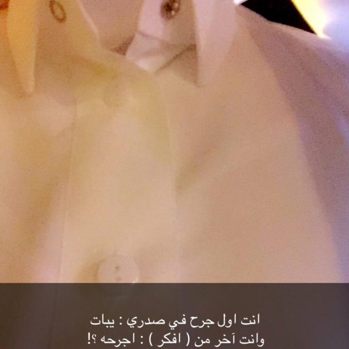 تعالوا انضموا الي #BIGOLIVE  bigo.tv/sid/2313070557…