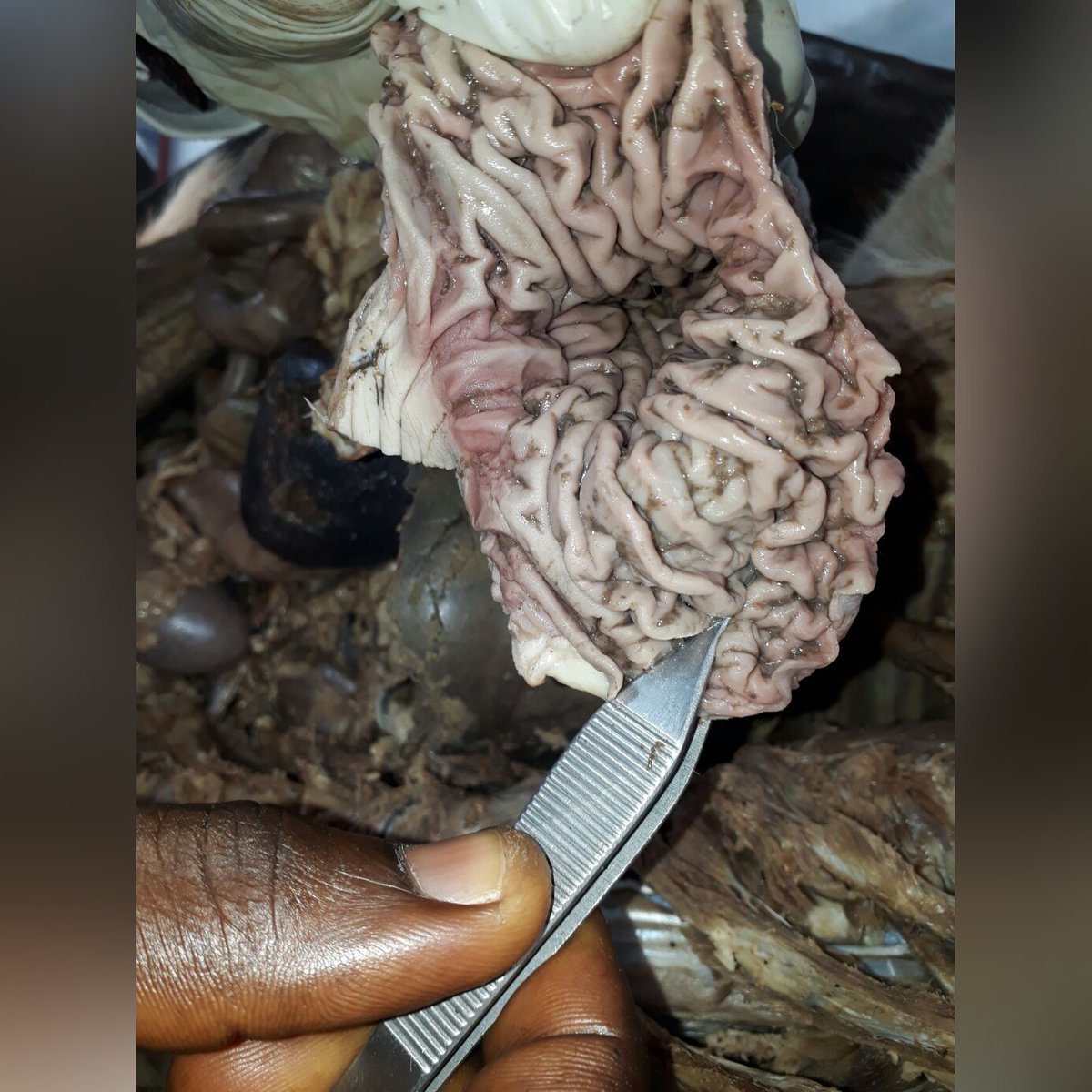 DonJay505's tweet photo. Practical Today. Inside the oesophagus
#Youngdoc 
#Still_In_Profession
#UniversityOfNigeria https://t.co/mU4O9VIeGk