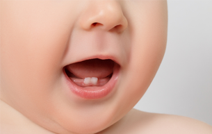 Denplan's tweet photo. It's important to protect your child's milk teeth. Read our blog to find out why they matter: https://t.co/0HY3MhI7wu #BigFamilyBrushUp #bfbu https://t.co/M9yDNL4UwS