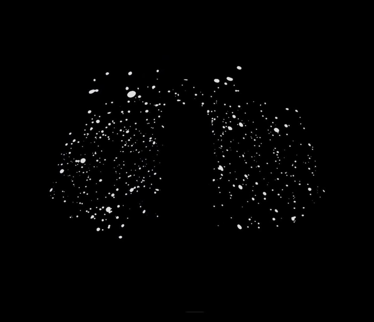 finalmouse's tweet photo. We wanted to wait to reveal this until every Phantom sold out. And now that it has: The Phantom was a one time production. While we will use phantomcord in the future the actual phantom with star splatter will not be made again. 25k Phantoms sold worldwide... simply amazing! https://t.co/ncz3Pj2WgJ