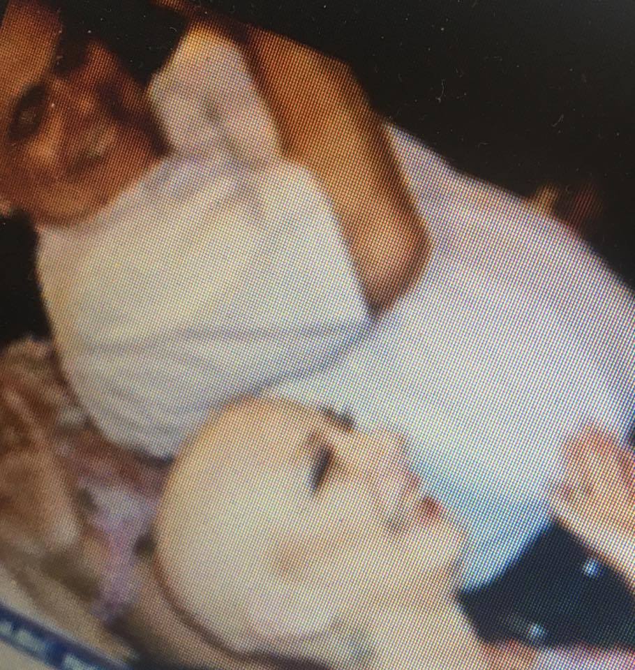 addilang's tweet image. a lot has happened since the first #press conference..... #ForeverChangedPressConference2018 
#hcsmSA #hcsmAfrica #symplur #cancer land is better with hair @Sam___Hurley @christheeagle1 @MiraSorvino @OncologyEvent @Cancerosity @ihadcancer @T_Mothotoane