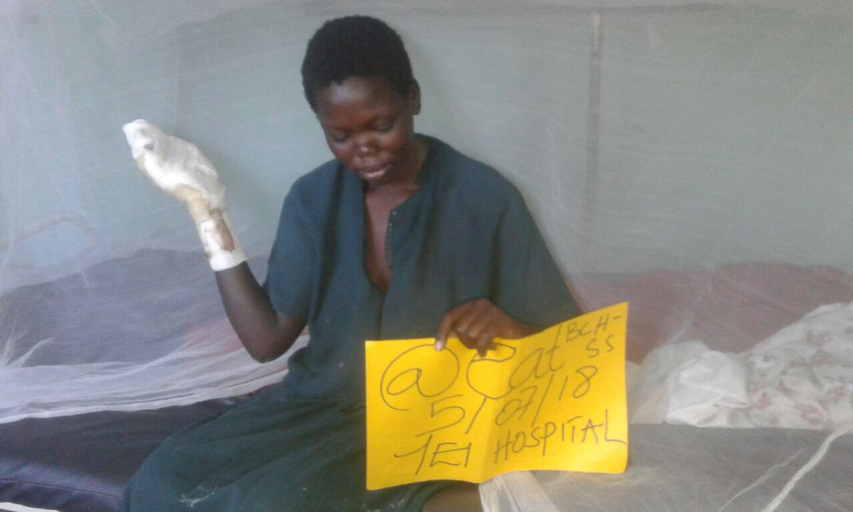 eatBCH_SS's tweet image. [yei] Ivana Nadia can now sit up in her bed! She burnt her hand when she fell in a fire during an epileptic fit, and as an orphan has been struggling to find food to recover while in the hospital. She is now getting stronger after eating these days! @AlexAxiomax @justoson_victor