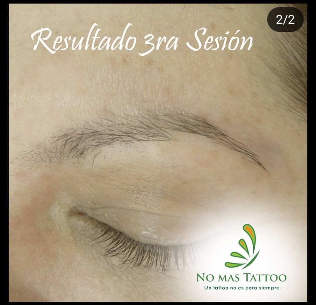 georgeremove's tweet image. Resultados sorprendentes.